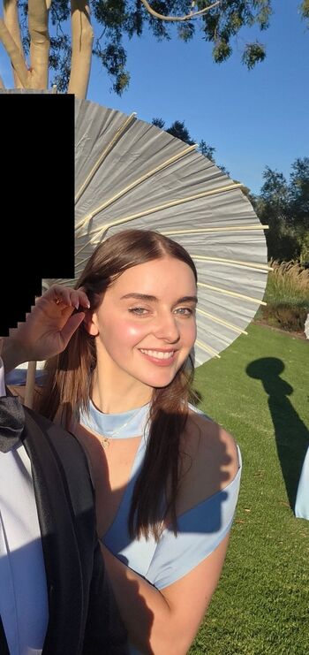 🔥 Loserfruit  page leaked private photo uncensored full