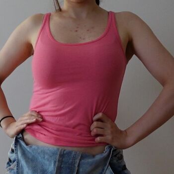 🔥 Loserfruit  page leaked private photo uncensored full