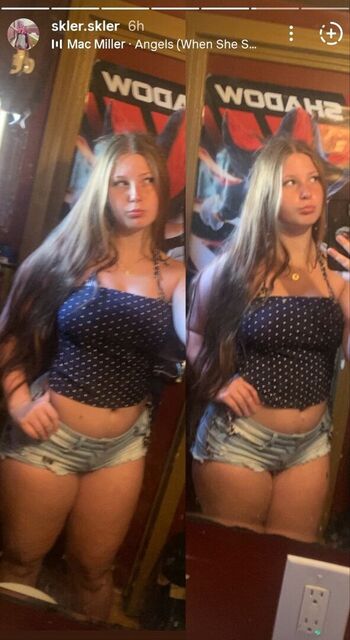 🔥 Skler leaked private photo uncensored full
