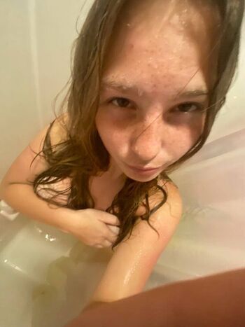 🔥 Skler leaked private photo uncensored full